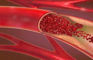 عدو خفي يتربص بقلبك.. علامات لا يجب تجاهلها