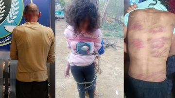 صورة موجعة: ربط ابنته إلى جذع شجرة.. وعنف زوجته وأولاده القصر! صورة موجعة: ربط ابنته إلى جذع شجرة.. وعنف زوجته وأولاده القصر!
