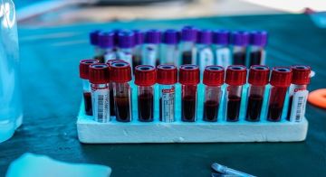 خمسة مؤشرات في الدم تكشف مشكلات صحية خطيرة