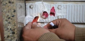 إقفال مركز تجميل غير مرخص ويقوم بأعمال مخالفة دون إشراف طبي في منطقة جل البحر العباسية إقفال مركز تجميل غير مرخص ويقوم بأعمال مخالفة دون إشراف طبي في منطقة جل البحر العباسية