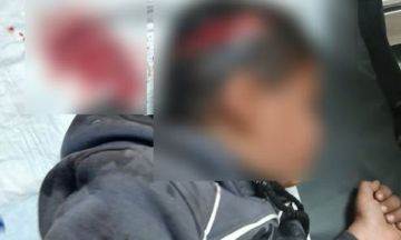 كلب يمزق فروة رأس طفل في بعلبك