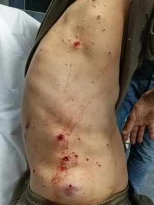 اصابة شخص في منطقة برج البراجنة جراء سقوط قذيفة الـB7 اثر اشكال في حي السلم