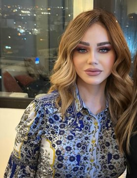 أطلت بوجه مشدود وشفاه ممتلئة.. ميادة الحناوي تقلب مواقع التواصل أطلت بوجه مشدود وشفاه ممتلئة.. ميادة الحناوي تقلب مواقع التواصل