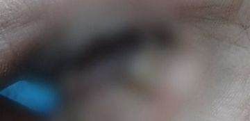 طفل يتعرض لإصابة خطيرة في طرابلس.. هذا ما حصل!