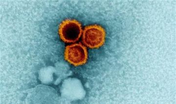 انتشار فيروس بلا لقاح أو علاج في أميركا.. وهذه أعراضه انتشار فيروس بلا لقاح أو علاج في أميركا.. وهذه أعراضه