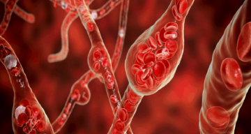 دراسة روسية تكشف القوميات الأكثر عرضة لنقص فيتامين D