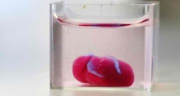 ارتفاع ضغط الدم قد يكشف اضطرابات خفية في الغدد الصماء