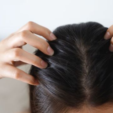 لماذا يزداد جفاف فروة الرأس وتهيجها في الشتاء وما هو الحل؟