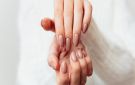 سبب تكسر الأظافر من أهمها نقص الفيتامينات في الجسم