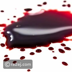 لا يحملها سوى 3 أشخاص.. علماء يكتشفون أندر فصيلة دم في العالم