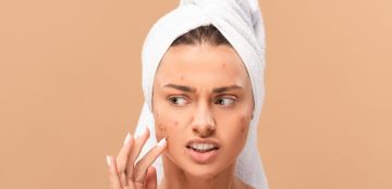 كيف تعتنين ببشرتك عند ظهور حبة قبل المناسبة بيوم؟ كيف تعتنين ببشرتك عند ظهور حبة قبل المناسبة بيوم؟