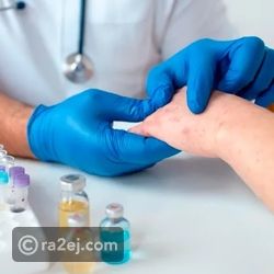 روسيا تعلن نتائج واعدة للقاح جديد ضد سرطان الجلد بفعالية تتجاوز 90