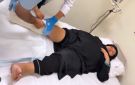 كسر في ساق فيفي عبده