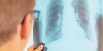 تتبع برنامج مكافحة مرض السل محور اجتماع تنسيقي بفاس