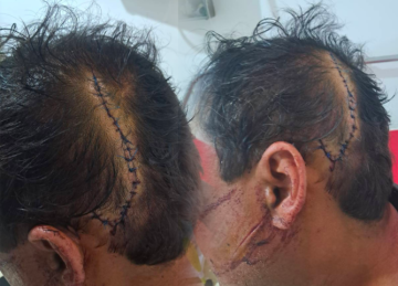 حكم مخفف على متهم بـاعتداء خطير في أكادير يشعل مواقع التواصل الاجتماعي