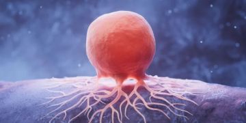 ابتكار جهاز من الماس لتتبع الخلايا السرطانية دون مواد مشعة