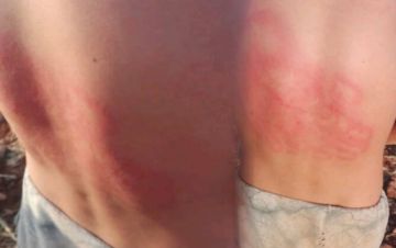 اعتداء جسدي على راعي أغنام يثير غضبا بأزيلال ويستنفر حقوقيين (صور) اعتداء جسدي على راعي أغنام يثير غضبا بأزيلال ويستنفر حقوقيين (صور)