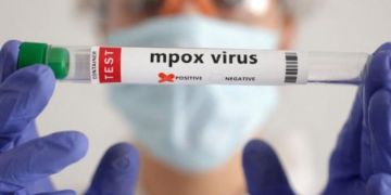 تسجيل إصابتين جديدتين بجدري القردة في السنغال تسجيل إصابتين جديدتين بجدري القردة في السنغال