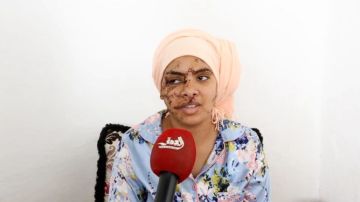 تشويه وجه شابة على يد طليقها يثير صدمة واسعة ويعيد للواجهة ملف تزويج ضحايا الاغتصاب