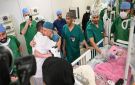 نجاح عملية فصل توأم ملتصق مغربي بعد عملية دامت ست ساعات بالسعودية