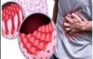 ضمنها العياء واضطرابات الهضم.. وزارة الصحة تحذر المغاربة من أعراض مرض السيلياك - ma