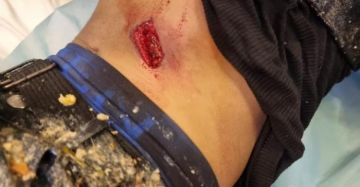 إصابة طفلين برصاص الاحتلال في رام الله إصابة طفلين برصاص الاحتلال في رام الله