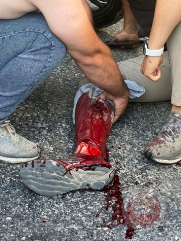 الخليل: إصابة شاب برصاص الاحتلال ومصادرة معدات من الجمعية الخيرية الإسلامية الخليل: إصابة شاب برصاص الاحتلال ومصادرة معدات من الجمعية الخيرية الإسلامية