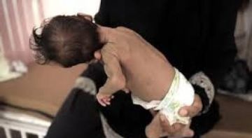 وفاة طفلين نتيجة التجويع وسوء التغذية في غزة وفاة طفلين نتيجة التجويع وسوء التغذية في غزة