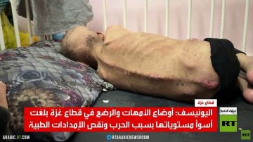 320 ألف طفل بغزة مهددون بسوء التغذية