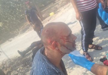 صور.. إصابة مواطن وأربعة متضامنين أجانب جراء اعتداء مستعمرين عليهم في بورين