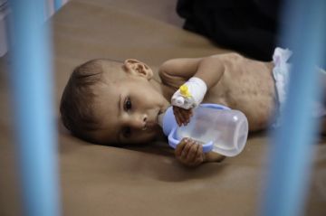  يونيسف : 9 آلاف طفل دون 5 سنوات في غزة يعانون سوء تغذية حاد