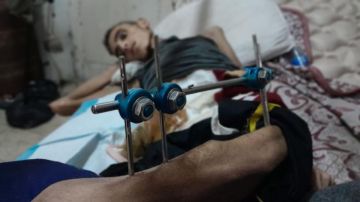 أصيب برصاصة متفجرة.. دغمش يصارع الموت على أسرة العلاج