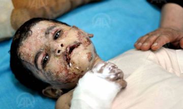 الاورومتوسطي: 1000 طفل جريح بغزة يعانون إعاقات دائمة