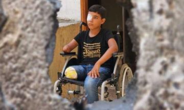 مركز الأطراف الصناعية: استقبلنا 600 حالة من مبتوري الأطراف بحرب غزة