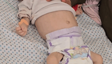 ترجيحات بارتفاع أعداد الوفيات بسبب الجوع بغزة ترجيحات بارتفاع أعداد الوفيات بسبب الجوع بغزة