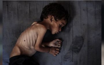 غزة.. ثماني وفيات جديدة نتيجة المجاعة وسوء التغذية