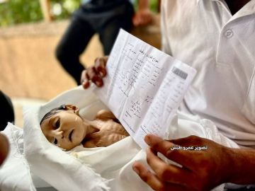 وفاة رضيعة جراء التجويع في غزة