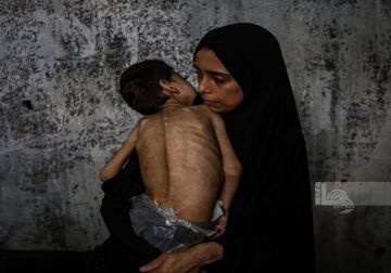 3 وفيات نتيجة المجاعة وسوء التغذية خلال الـ24 ساعة الماضية