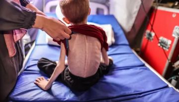 8 وفيات نتيجة المجاعة وسوء التغذية خلال الـ24 ساعة الماضية