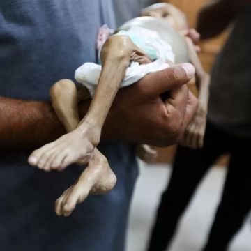 خلال الـ 24 ساعة الماضية.. 5 حالات وفاة جراء المجاعة وسوء التغذية بغزة