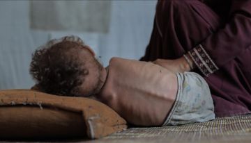 10 وفيات بينها 3 أطفال نتيجة التجويع في غزة خلال الساعات الماضية 10 وفيات بينها 3 أطفال نتيجة التجويع في غزة خلال الساعات الماضية