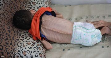 بينهم 110 أطفال.. ارتفاع عدد وفيات التجويع وسوء التغذية بغزة إلى 258 بينهم 110 أطفال.. ارتفاع عدد وفيات التجويع وسوء التغذية بغزة إلى 258