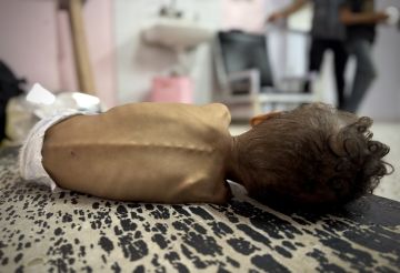 غزة: ارتفاع حصيلة ضحايا التجويع وسوء التغذية إلى 263 شخصا بينهم 112 طفلا