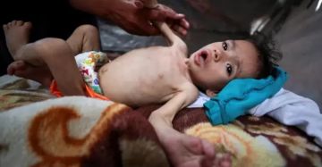 الصحة بغزة: 11 حالة وفاة نتيجة المجاعة وسوء التغذية خلال الـ 24 ساعة الماضية الصحة بغزة: 11 حالة وفاة نتيجة المجاعة وسوء التغذية خلال الـ 24 ساعة الماضية
