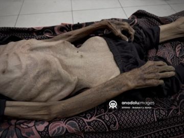 تسجيل 5 حالات وفاة جديدة نتيجة سوء التغذية في قطاع غزة تسجيل 5 حالات وفاة جديدة نتيجة سوء التغذية في قطاع غزة