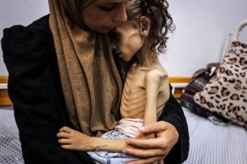 بينهم طفل- 11 حالة وفاة جديدة نتيجة المجاعة وسوء التغذية بغزة