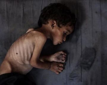 الصحة بغزة: ثمانية وفيات نتيجة المجاعة وسوء التغذية خلال الـ24 ساعة الماضية  الصحة بغزة: ثمانية وفيات نتيجة المجاعة وسوء التغذية خلال الـ24 ساعة الماضية