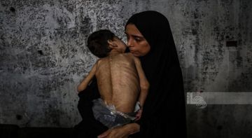 صحة غزة: تسجيل 11 حالة وفاة جديدة نتيجة التجويع وسوء التغذية صحة غزة: تسجيل 11 حالة وفاة جديدة نتيجة التجويع وسوء التغذية