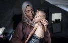 غزة: 3 وفيات نتيجة المجاعة وسوء التغذية خلال الـ 24 ساعة الماضية - ps