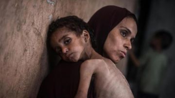 غزة: أربع وفيات بينهم طفل نتيجة المجاعة وسوء التغذية خلال الـ24 ساعة الماضية